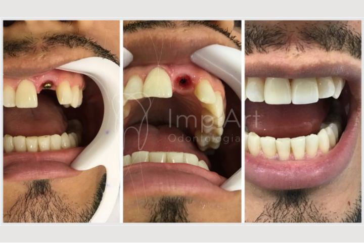 O que fazer quando o paciente não sabe onde está doendo? – Dental