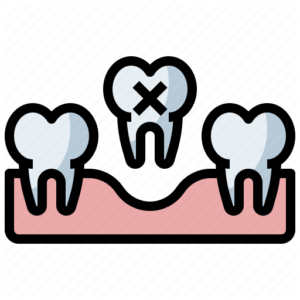perda_ossea_dentaria