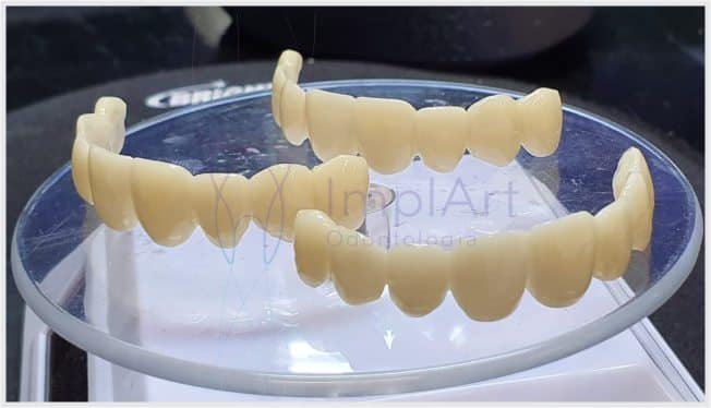 dentes provisorios impressos