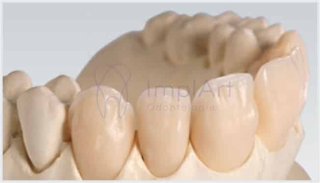 dentes provisorios 46kb