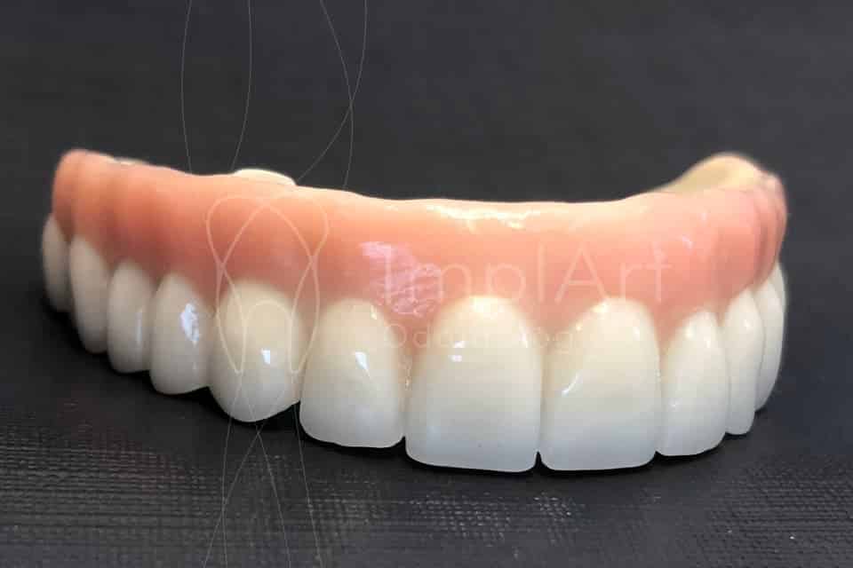 zirconia_dental_translucida_estetica_960x640_34kb ImplArt
