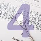 como é feito um implante dentário 27
