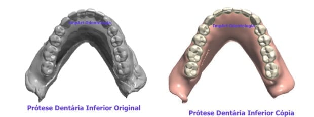 cópia de prótese dentária dentadura