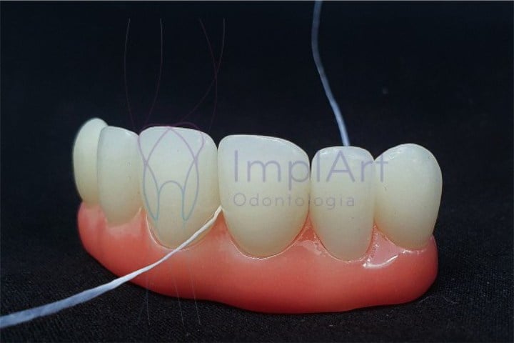 dentes individuais