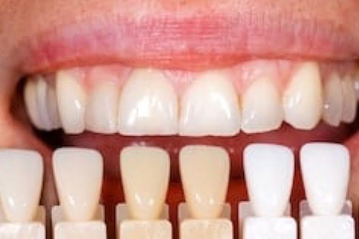 cor dos dentes