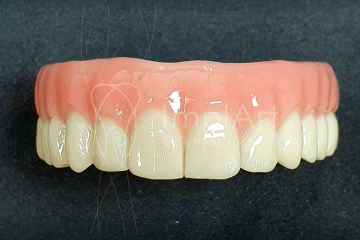 protese total fixa em zirconia