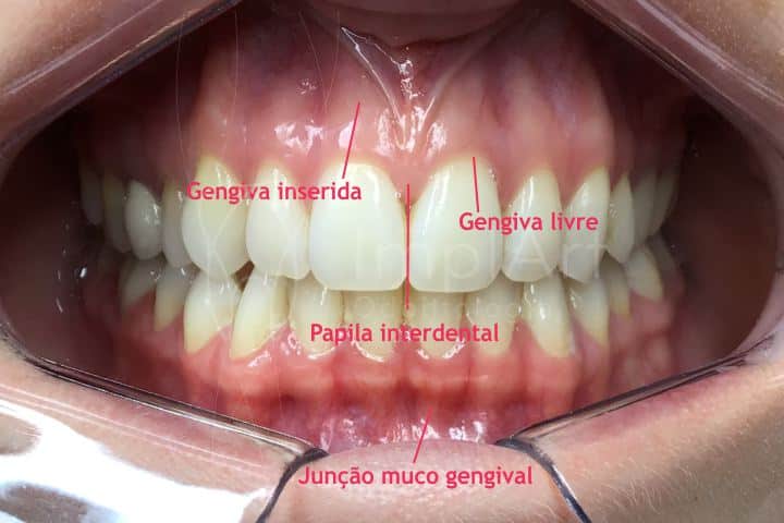 dentes saudáveis