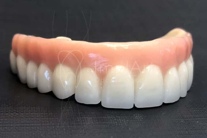 implante total com protese fixa em zirconia estetica