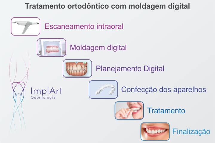 tratamento ortodôntico digital