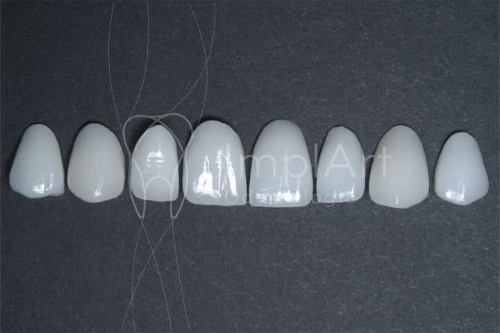 lentes de contato dentais 50kb