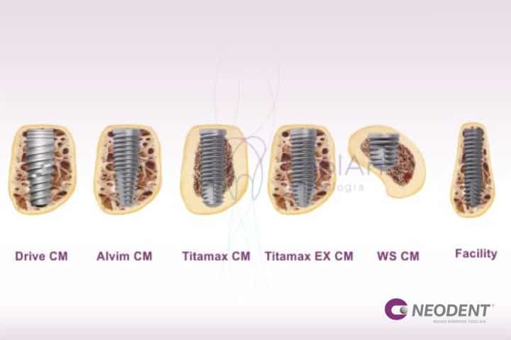 linha de implantes neodent implart 50kb