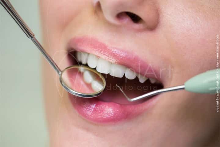 limpeza nos dentes