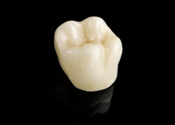 coroa dentaria 3D de porcelana estetica 49kb