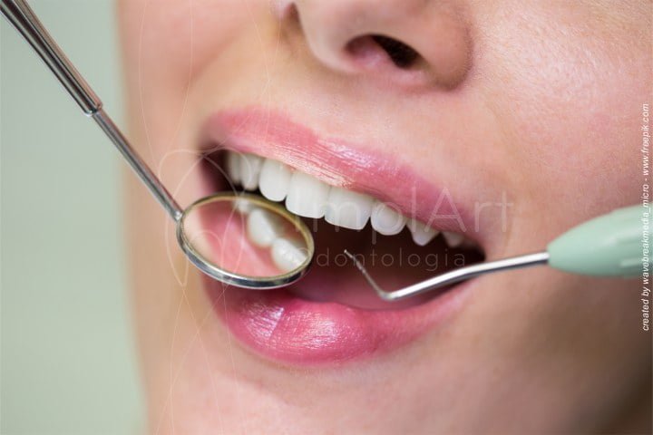 limpeza dos dentes profissional 2 50kb