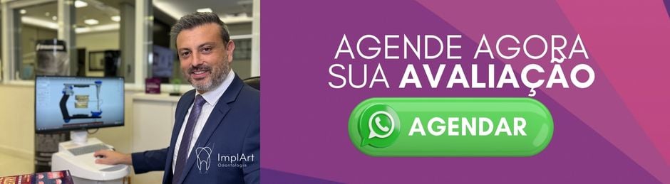 Lente de Contato preço agende agora sua avaliaçao para implante dentario na Clinica ImplArt