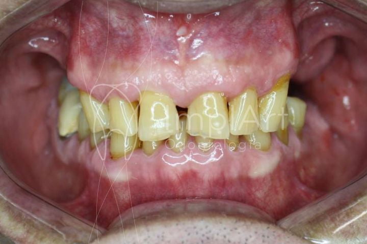dentes amarelados idade 50kb