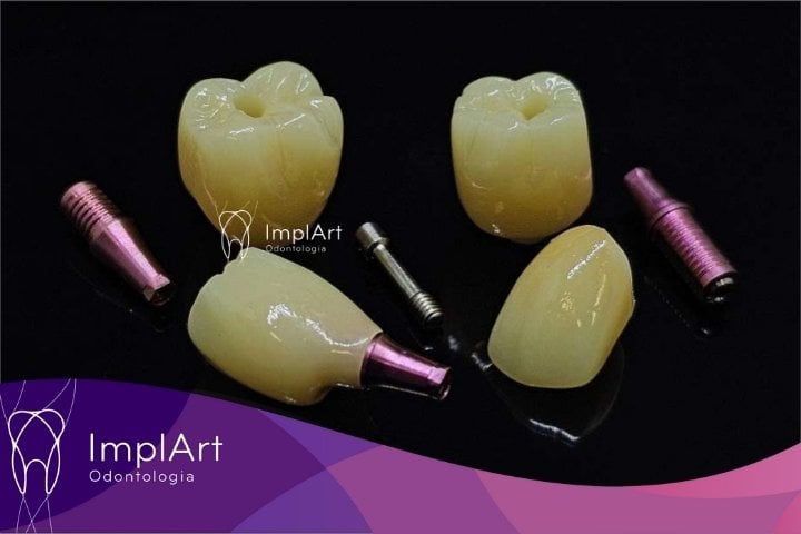 coroa dentaria zirconia
