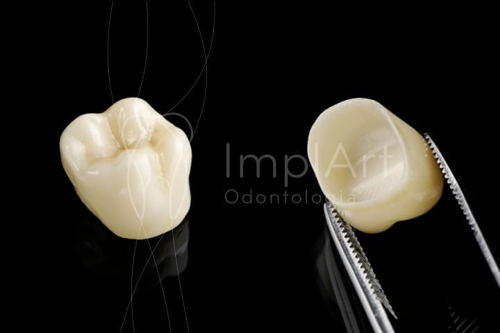 coroa de zirconia pura 50kb