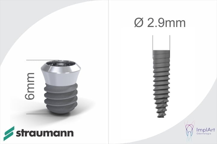 novos tipos de implante dentário curto