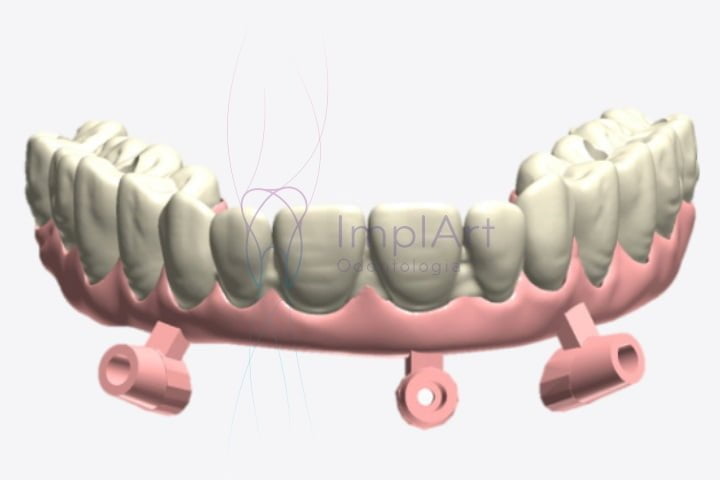 impressora 3d ultracraft chairside pro 45kb