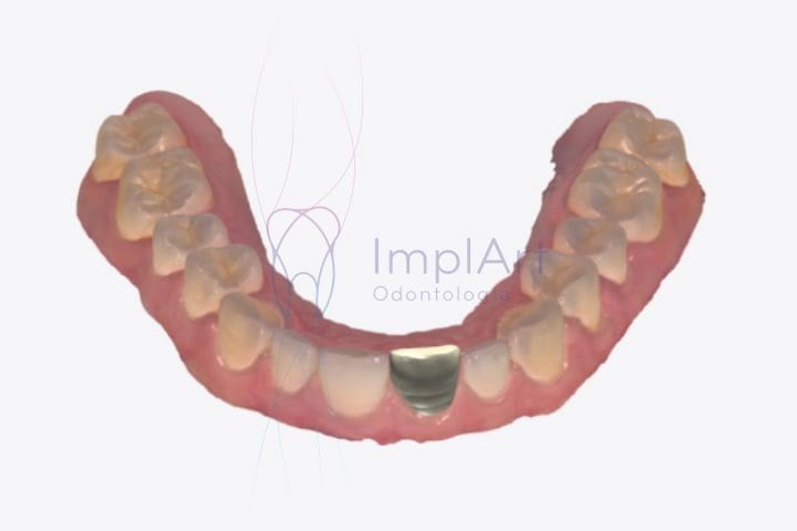 impressora 3d ultracraft chairside pro 46kb