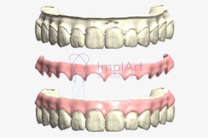 impressora 3d ultracraft chairside pro 47kb