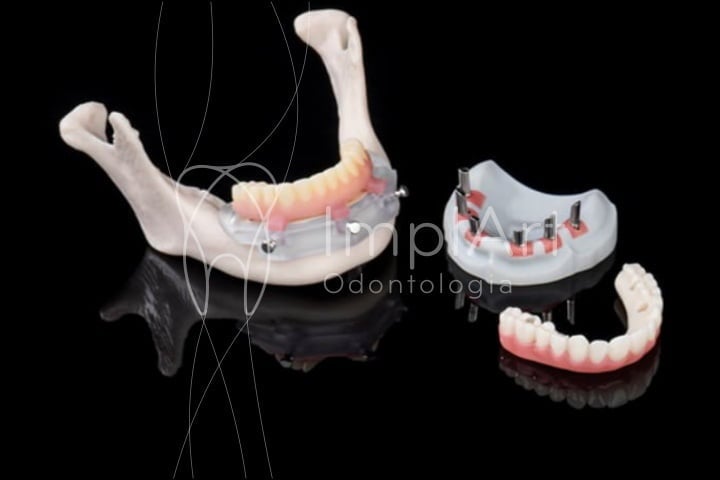 impressora 3d ultracraft chairside pro 48kb