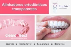 alinhador transparente clearcorrect straumann 50kb