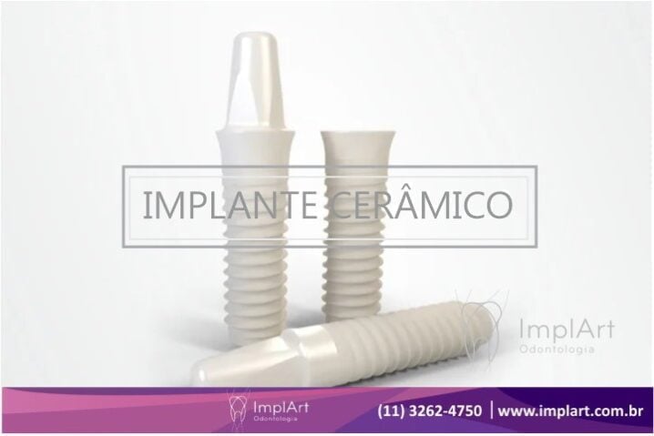 Implante dentario cer&acirc;mico