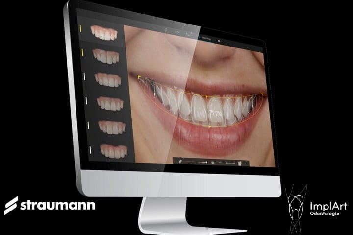 software smilecloud straumann funciona com inteligência artificial