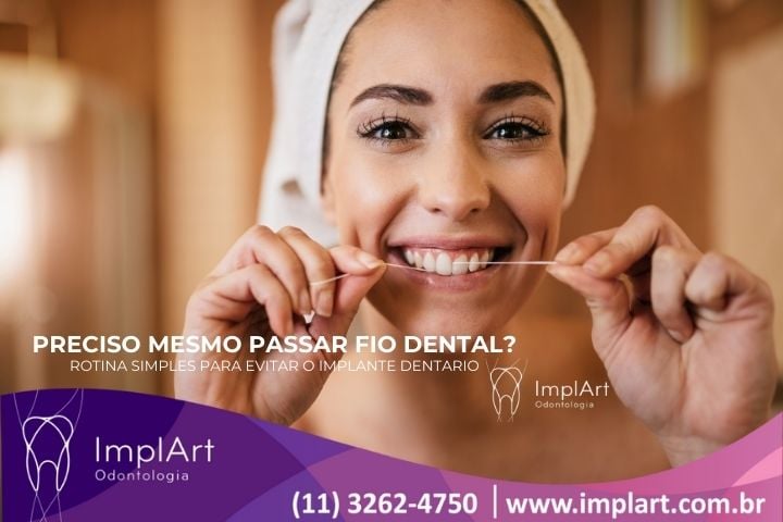 Implantes Dent&aacute;rios por Falta de Fio Dental