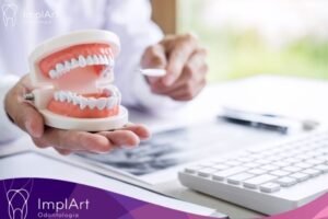 implante dentario com protese protocolo