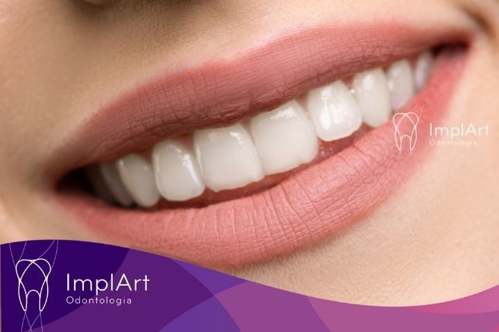 harmonização dental