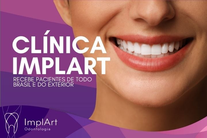 melhor clinica de implante dentario