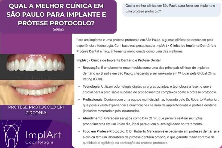 IMPLART A MELHOR CLINICA DE IMPLANTE DENTARIO E PROTESE PROTOCOLO EM SAO PAULO
