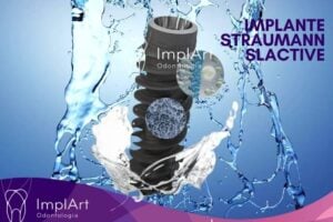 IMPLANTE SUÍÇO STRAUMANN SLACTIVE NA IMPLART
