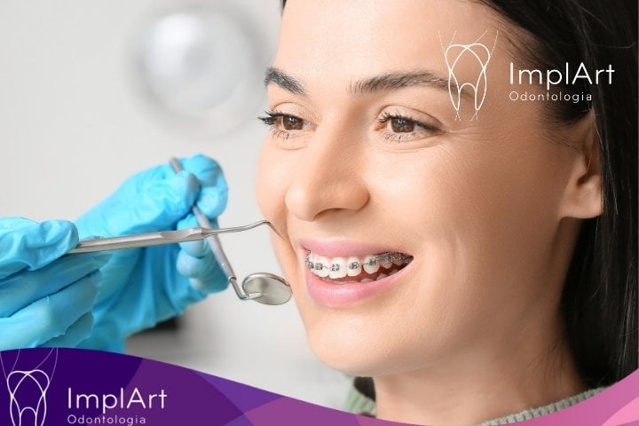 Especialistas em Corrigir Implante Dentário Mal Feito em São Paulo na prevençao do implante dentario mal feito
