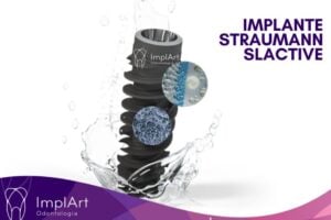 implante suíço straumann slactive