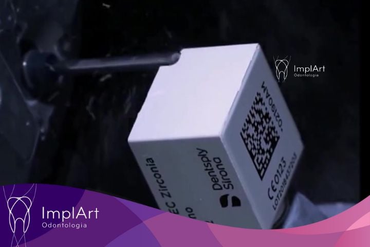 Planejamento Digital do Sorriso impressora 3D