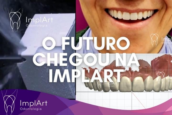 futuro do seu sorriso está na implart com planejamento digital do sorriso