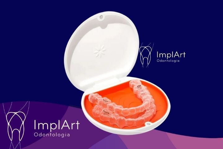 Riscos de Usar Aparelho Ortodôntico por Muito Tempo contenção vivera riscos de usar aparelho e não usar contenção