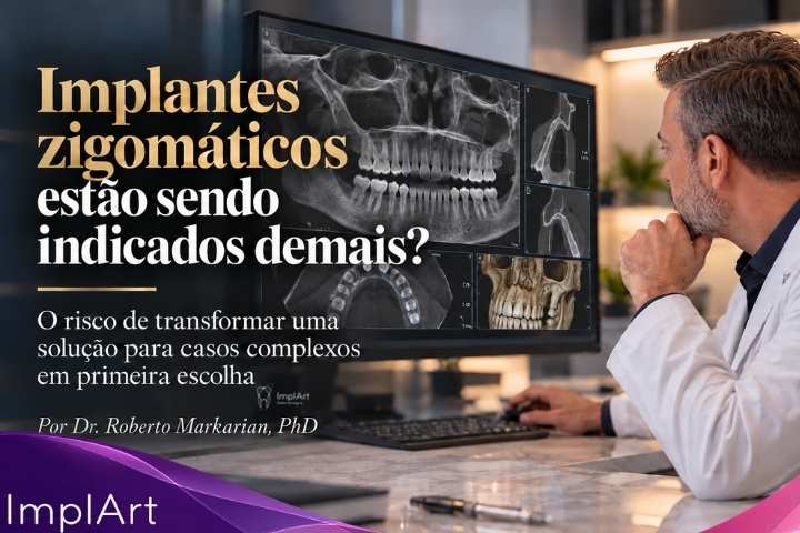 zygomatic implant