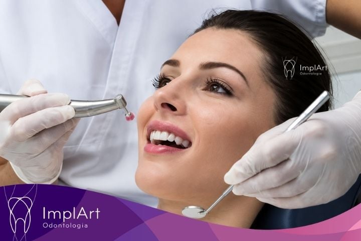 limpeza no dentista para implante dentario