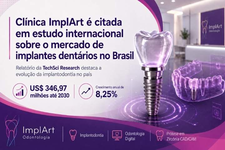 Cl&iacute;nica ImplArt &eacute; citada entre os principais participantes do mercado brasileiro de implantes dent&aacute;rios