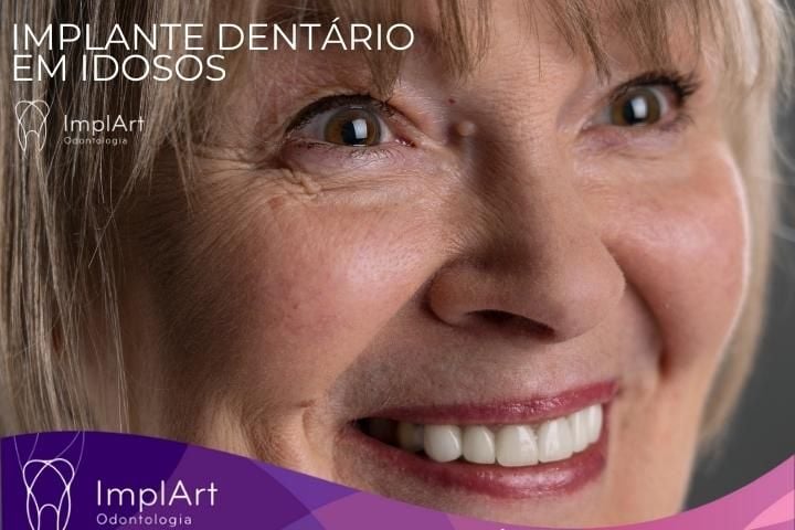 Dental Implants in the Elderly: Is it Safe? Benefits of implants on quality of life dental implants for the elderly