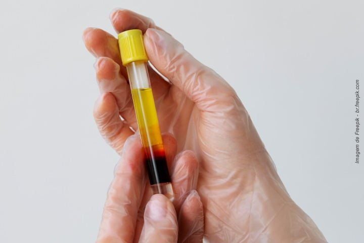 Existe o uso de células-tronco em Odontologia? células-tronco