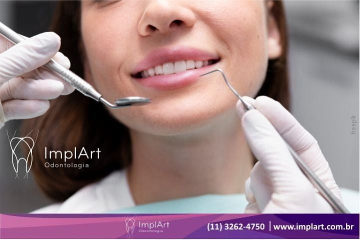 care of dental implants