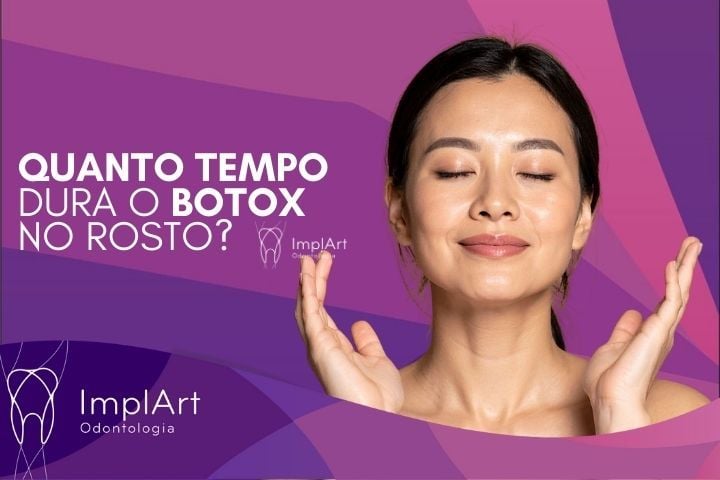 Quanto tempo dura o Botox no Rosto? ImplArt é uma Clínica recomendada para aplicação de botox em São Paulo quanto tempo dura o botox