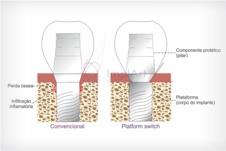 Platform switch