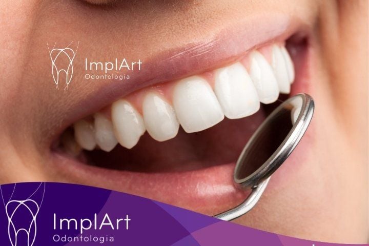 dental implant prosthesis protocol